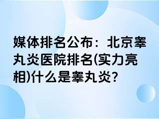 媒体排名公布：北京睾丸炎医院排名(实力亮相)什么是睾丸炎？