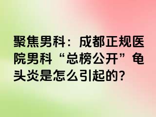 聚焦男科：成都正规医院男科“总榜公开”龟头炎是怎么引起的？
