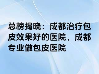 总榜揭晓：成都治疗包皮效果好的医院，成都专业做包皮医院